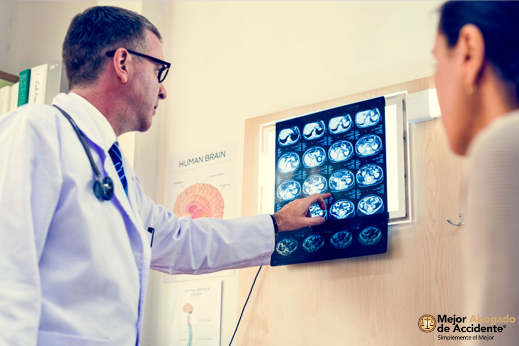 Best Las Vegas brain Injury Attorney _ mejor abogado